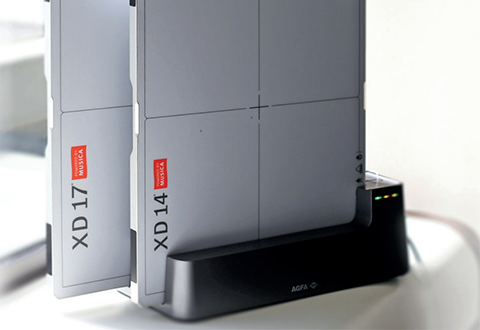 Detector Digital Rayos X XD14