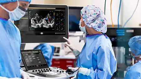 Imagen excepcional - Philis EPIQ CVx