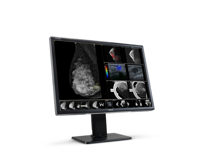 NioFusion12mp2