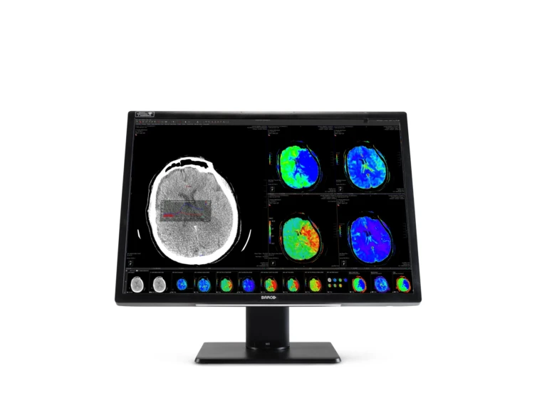 NioFusion12mp9