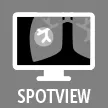 SpotView