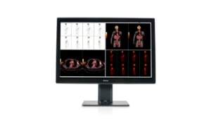 Monitor de grado médico Barco mostrando estudios de tomografía